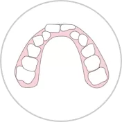 Ectopia dental individual