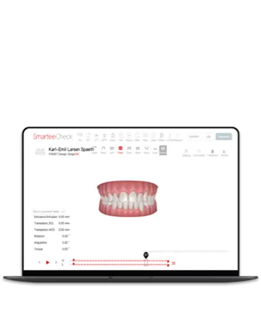 Simulación de tratamiento virtual
