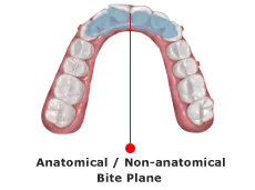 Dispositivo de reposicionamiento mandibular con plano de mordida