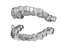 Aparato Clear para aliviar el síndrome de apnea obstructiva del sueño (SAOS)