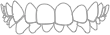 Protrusión