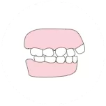 Dientes abocinados