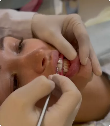 Simulación de reposicionamiento mandibular: