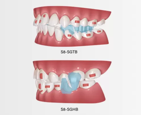 Dispositivo de reposicionamiento mandibular para avance mandibular