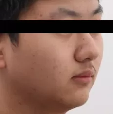 Fotografías faciales antes del tratamiento