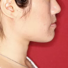 Fotografías faciales antes del tratamiento