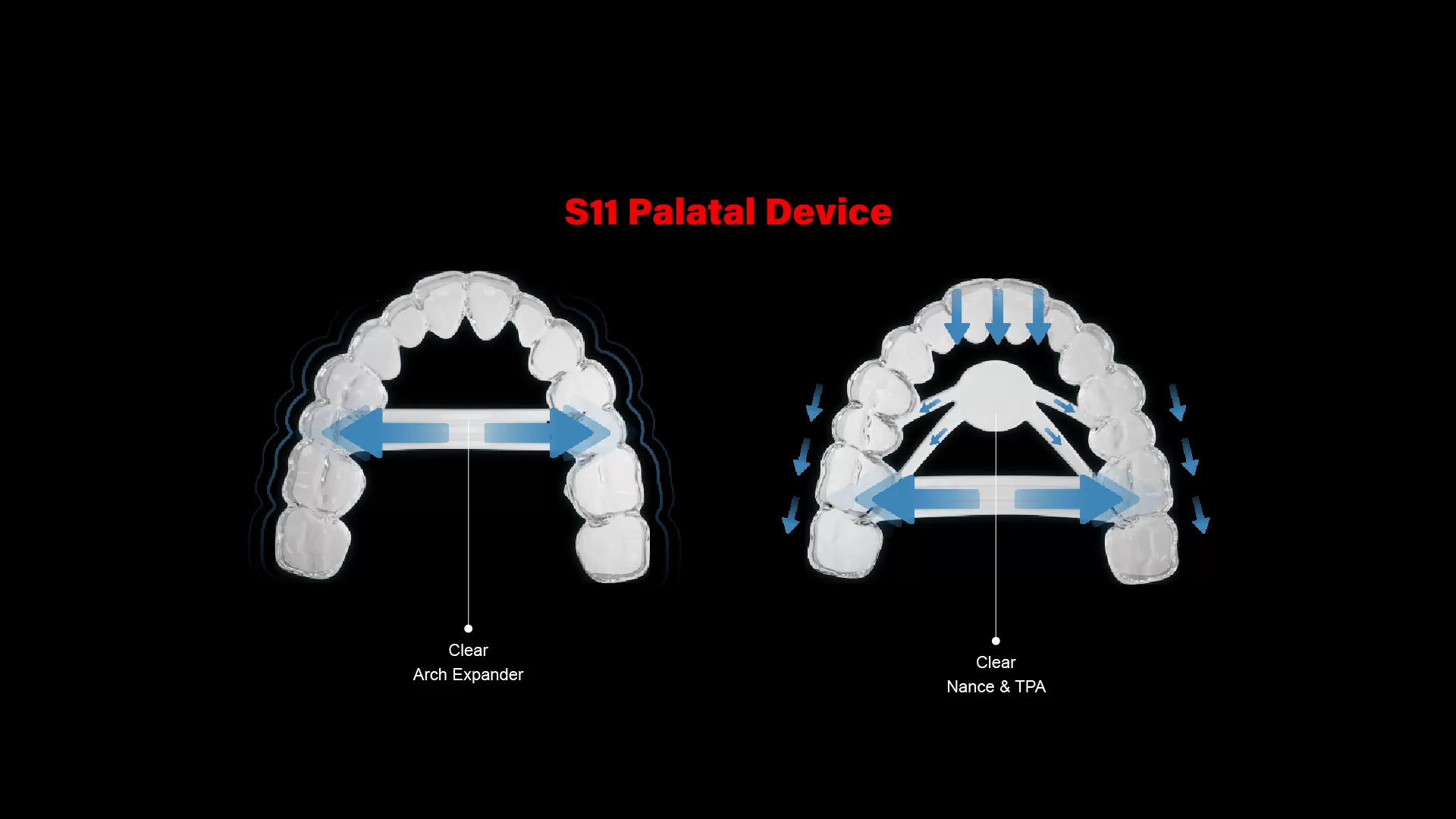 Dispositivo Palatino S11