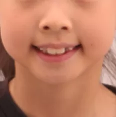 Fotografías faciales antes del tratamiento