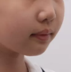 Fotografías faciales antes del tratamiento