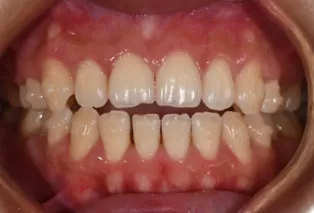 Fotografías intraorales